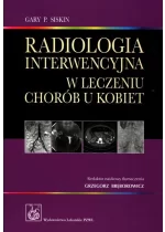 Radiologia interwencyjna w leczeniu chorób u kobiet