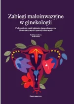 Zabiegi małoinwazyjne w ginekologii