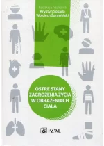 Ostre stany zagrożenia życia w obrażeniach ciała
