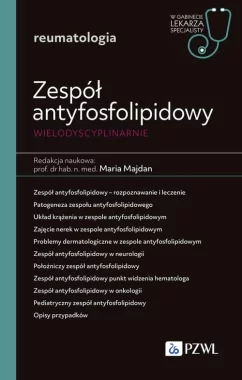Zespół antyfosfolipidowy wielodyscyplinarnie W gabinecie lekarza specjalisty Reumatologia