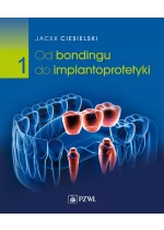 Od bondingu do implantoprotetyki. Cz. I