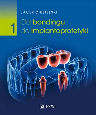 Od bondingu do implantoprotetyki. Cz. I