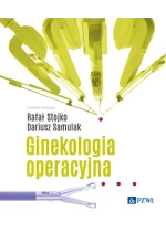 Ginekologia operacyjna