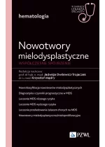 Nowotwory mielodysplastyczne. Współczesne spojrzenie