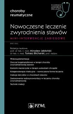 Nowoczesne leczenie zwyrodnienia stawów. Mini-interwencje zabiegowe