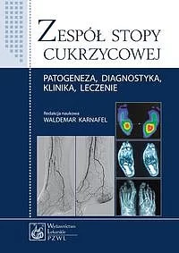 Zespół stopy cukrzycowej
