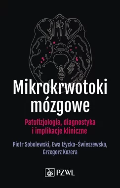 Mikrokrwotoki mózgowe