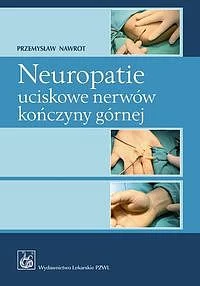 Neuropatie uciskowe nerwów kończyny górnej