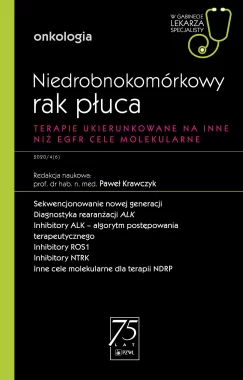 Niedrobnokomórkowy rak płuca. W gabinecie lekarza specjalisty.