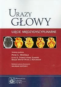 Urazy głowy