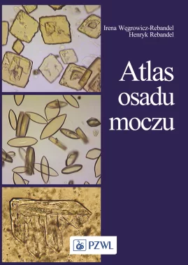 Atlas osadu moczu
