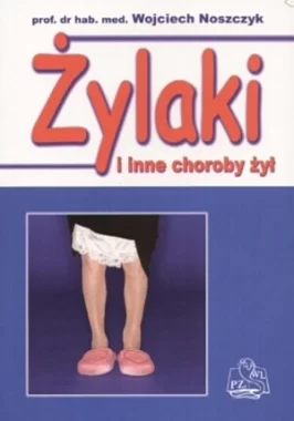 Żylaki i inne choroby żył