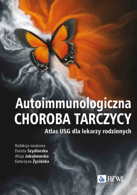 Autoimmunologiczna choroba tarczycy