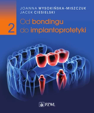 Od bondingu do implantoprotetyki. Cz. II