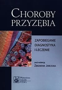 Choroby przyzębia