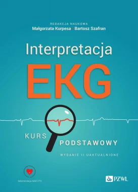 Interpretacja EKG.
