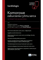 Komorowe zaburzenia rytmu serca Outlet