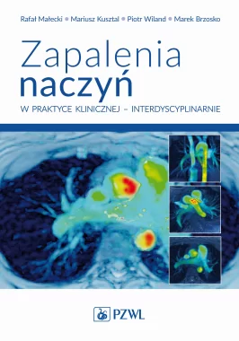 Zapalenia naczyń – w praktyce klinicznej interdyscyplinarnie